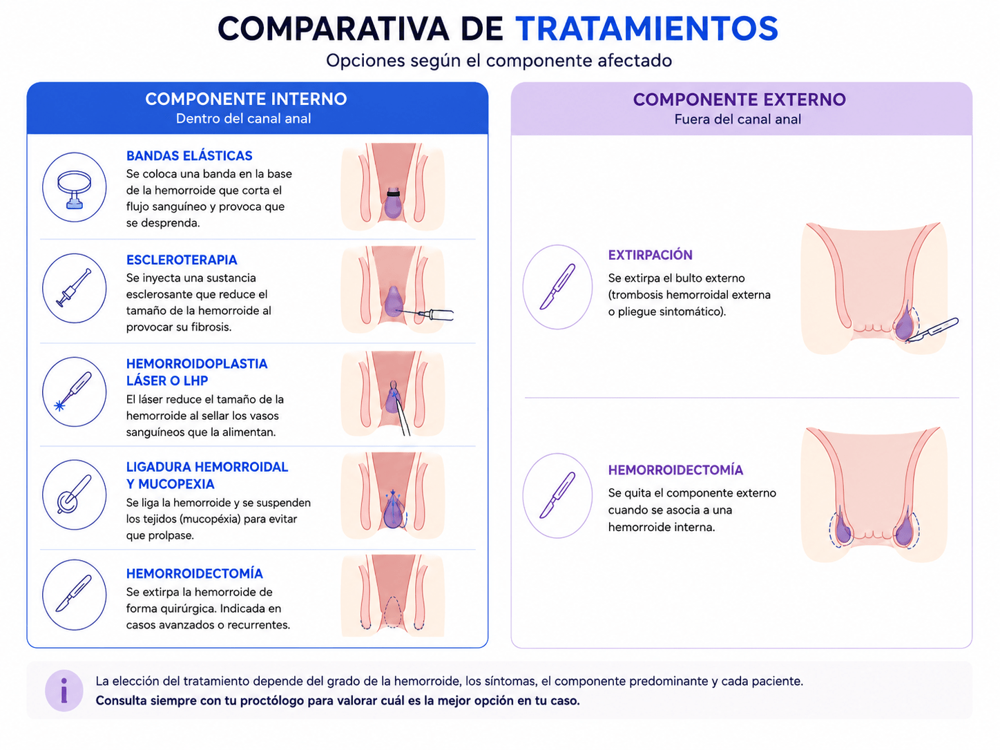 Comparativa de tratamientos según el componente afectado: bandas, escleroterapia, láser y hemorroidectomía para el componente interno; extirpación y hemorroidectomía para el componente externo
