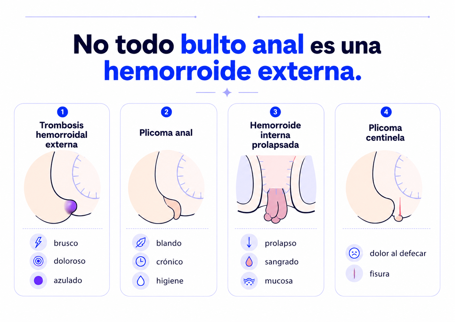 Cuatro tipos de bulto anal: trombosis hemorroidal externa, plicoma anal, hemorroide interna prolapsada y plicoma centinela