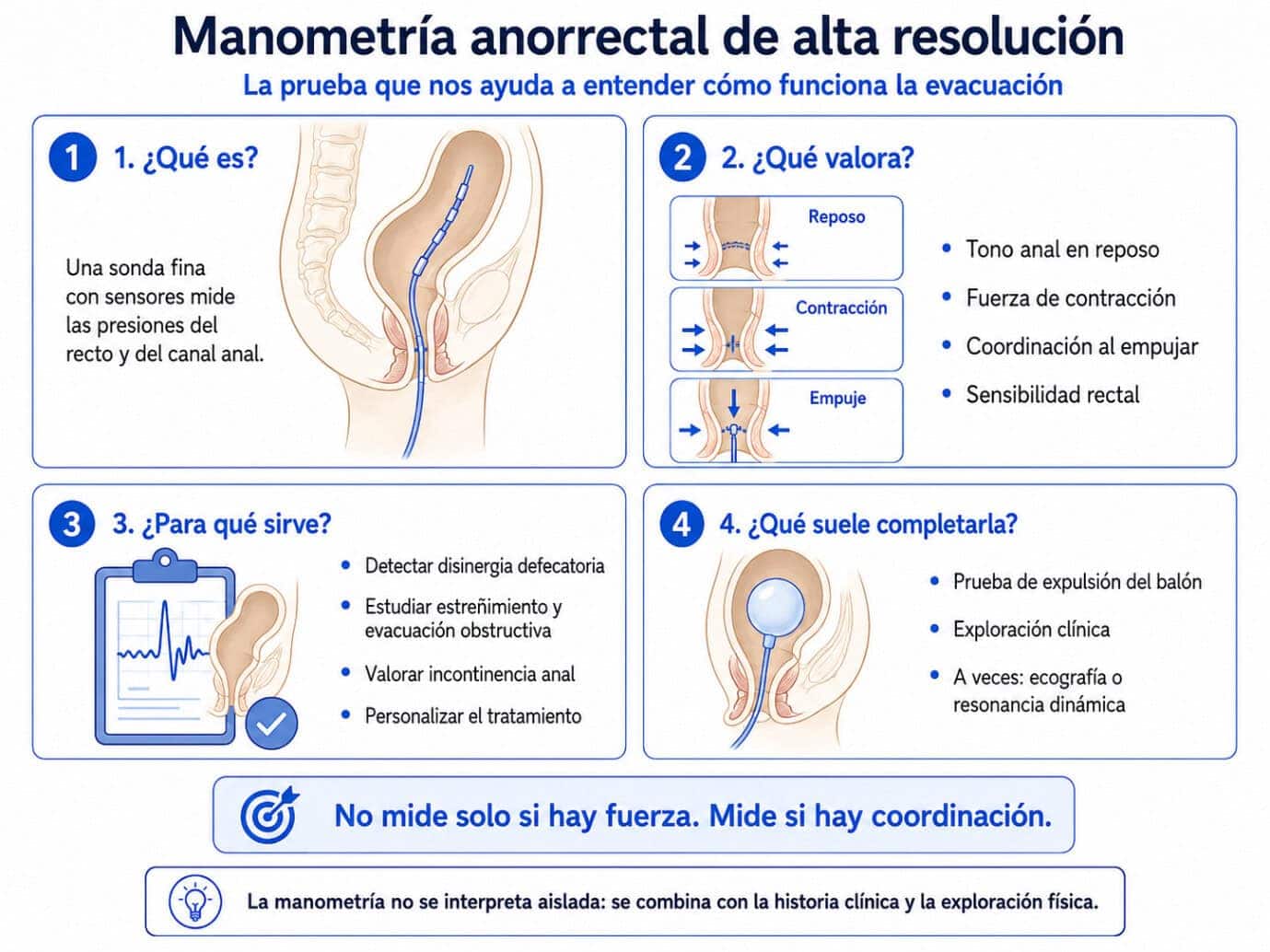 Infografía explicativa de la manometría anorrectal de alta resolución