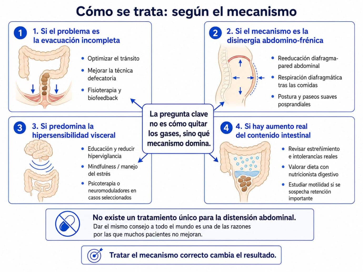 Infografía del tratamiento de la distensión abdominal según el mecanismo causante